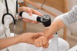 Carcinoma espinocelular: o que é, sintomas, causas e tratamento