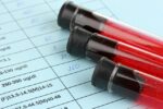 Hemograma Completo: para que serve, resultados (e alterações comuns)