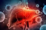 Hepatite A: o que é, sintomas, transmissão e tratamento