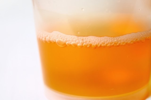 Urina com espuma: 7 principais causas (e o que fazer)