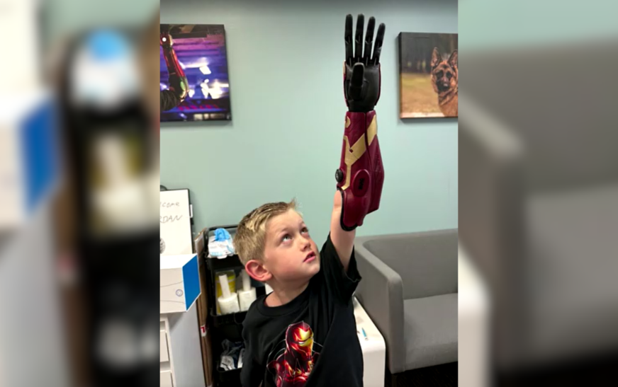 Criança de 5 anos se torna a mais jovem do mundo a usar “Braço de Herói“ biônico